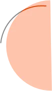orthodontiste-tournefeuille-rousseau